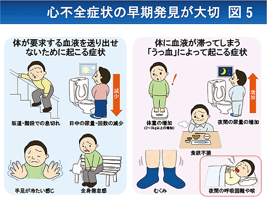 図 関連 心不全 病態 心不全の原因・メカニズム [心臓・血管・血液の病気]