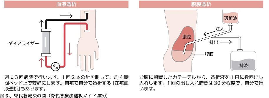 図3、腎代替療法の図(腎代替療法選択ガイド2020)